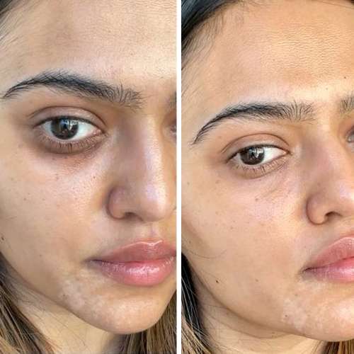 Buy Plix Guava Under Eye Gel for Dark Circles With 3 Niacinamide