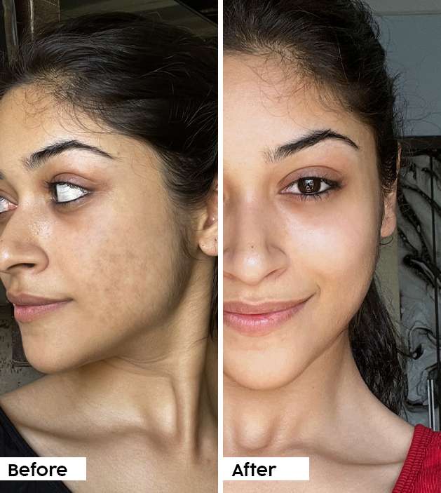 Buy Guava 3 Glycolic Acid Face Glow Serum Online Plix