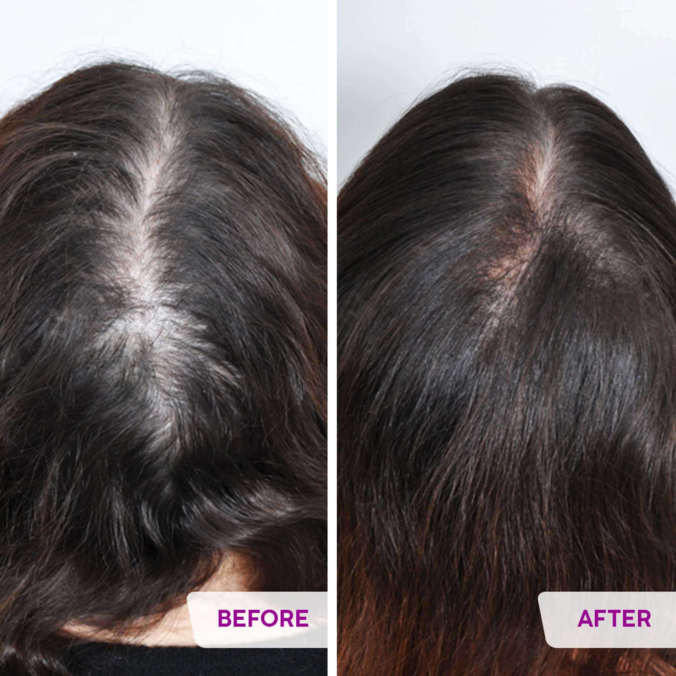 Buy Plix womens hair growth serum with 3% Redensyl For Healthy Hair
